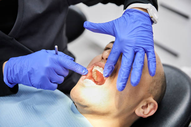 Best Emergency Broken Tooth Repair in Placitas, NM
